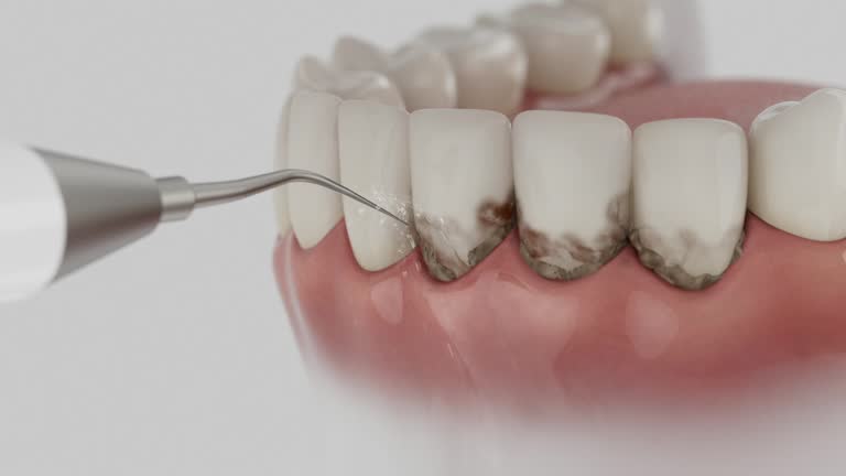 Reliable Dental contractor in Kensington, CA by Dentist Open Now
